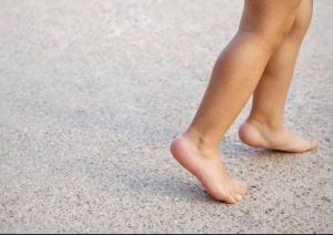 درمان راه رفتن روی پنجه پا