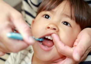 مزایای مراقبت از دندان های شیری