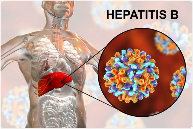 عائم و درمان بیماری هپاتیت B