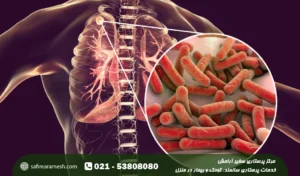 بیماری سل چیست؛ علت و علائم مریضی سل