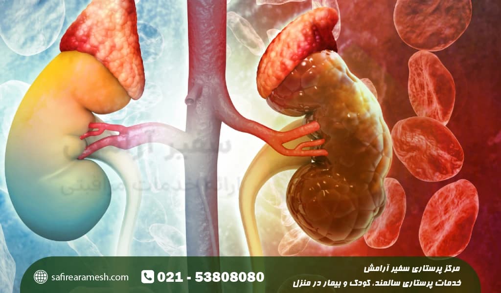 رایج ترین لیست بیماری های مزمن