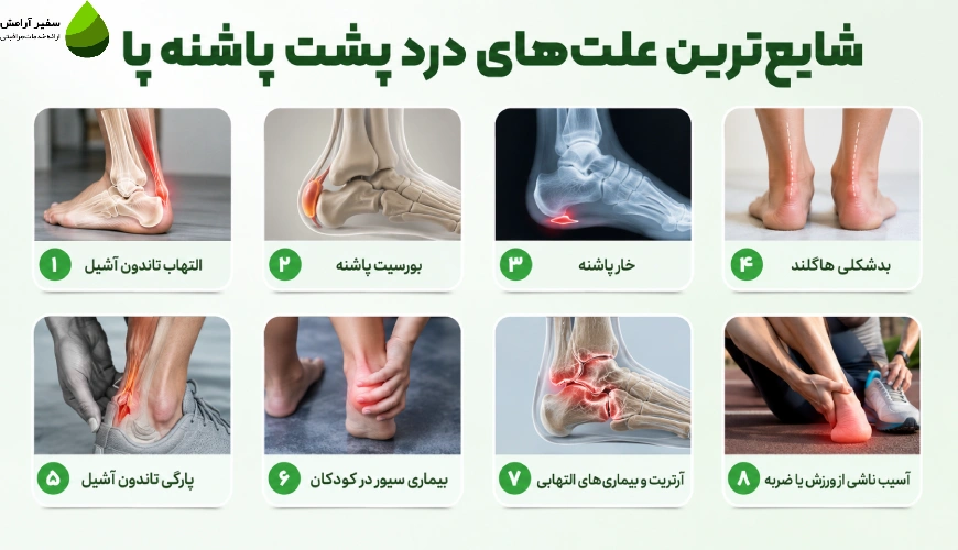 شایع ترین علت های درد پاشنه پا