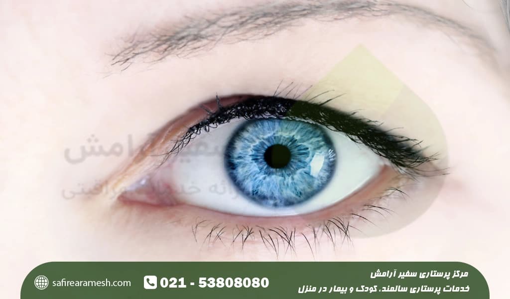 ارتباط چشم های آبی و سلامتی چیست؟