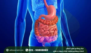 استرس و یبوست