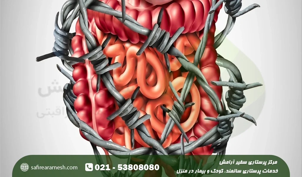 درمان انسداد روده کودکان در طب سنتی