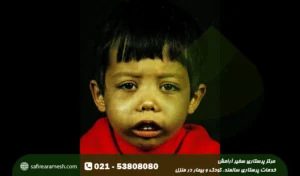 بیماری تالاسمی چیست؟