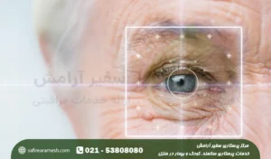 بیماری های چشمی سالمندان