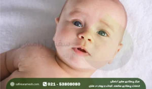 تورتیکولی یا کجی گردن نوزاد