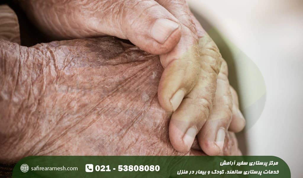 علت خشکی پوست سالمندان و افراد مسن
