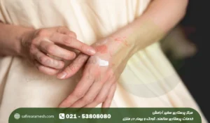 روش های درمان خانگی اگزما دست، صورت و سر