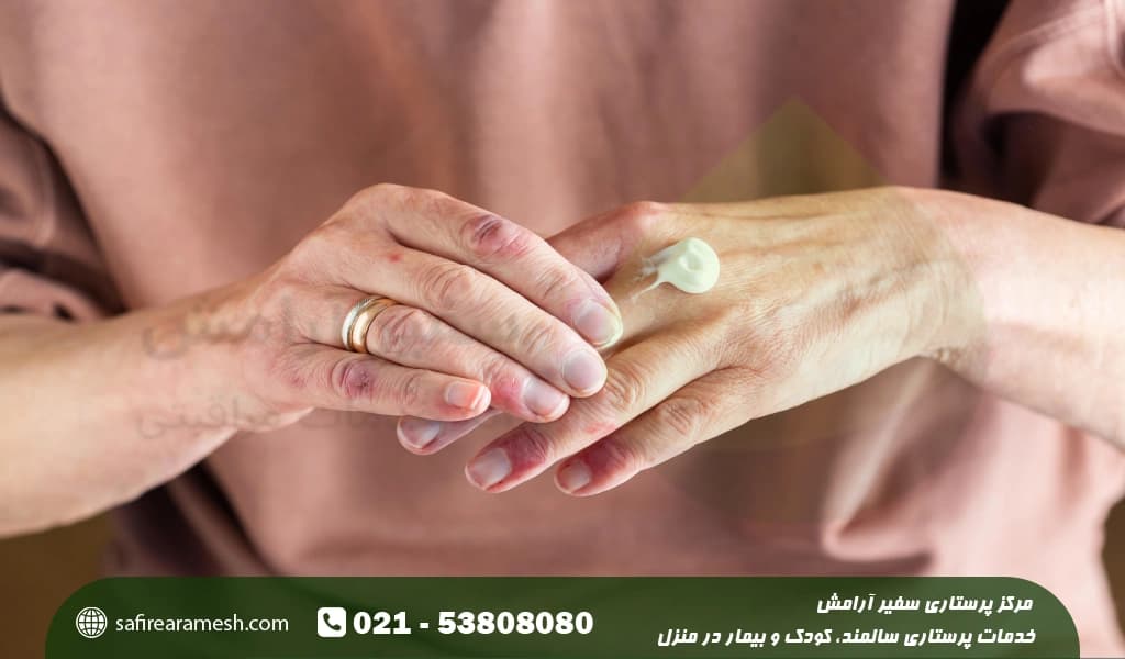علائم خشکی پوست سالمندان