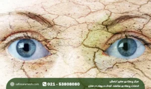 درمان قطعی سندروم شوگرن