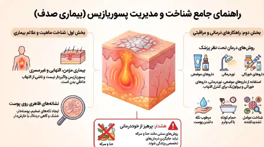 بیماری پسوریازیس