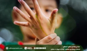 روماتیسم در کودکان