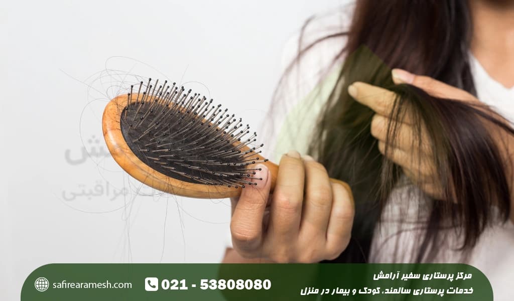 انواع ریزش مو زنان و خانم ها