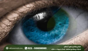 عکس چشم آبی؛ راه های آبی شدن چشم