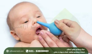 گرفتگی بینی نوزاد