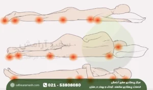 زخم بستر در سالمندان + نشانه ها و درمان قطعی آن در منزل