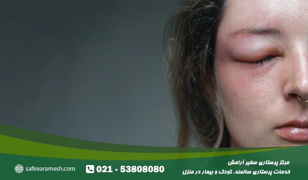 روشهای درمان پف صورت در سالمندان