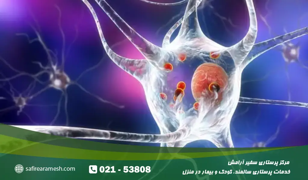 تفاوت بیماری als و ms