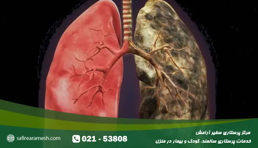 پاکسازی خون از نیکوتین