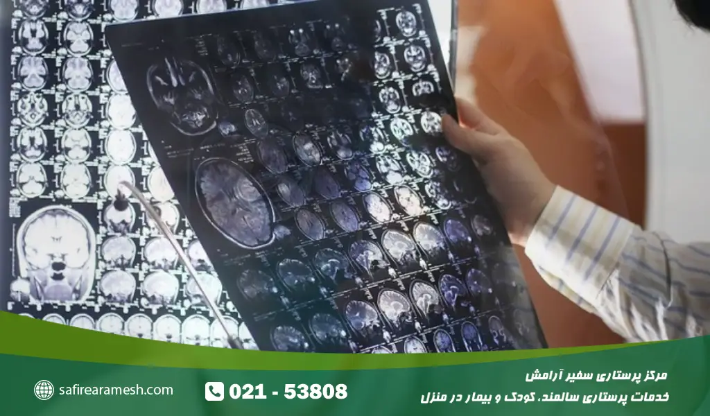 مراقبت از بیمار سندرم دویک