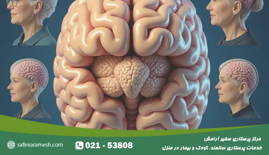 پیر شدن مغز