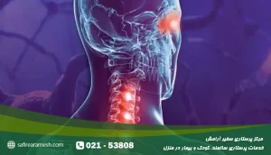 پرستار سندرم دویک