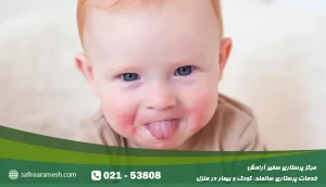 حساسیت پوستی در کودکان