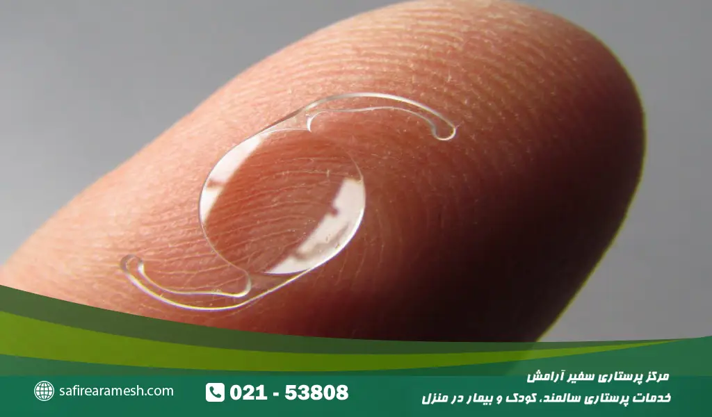 در روش لنز داخل چشمی (IOL) عدسی طبیعی چشم با یک لنز مصنوعی چندکانونی یا تک‌کانونی جایگزین می‌شود.