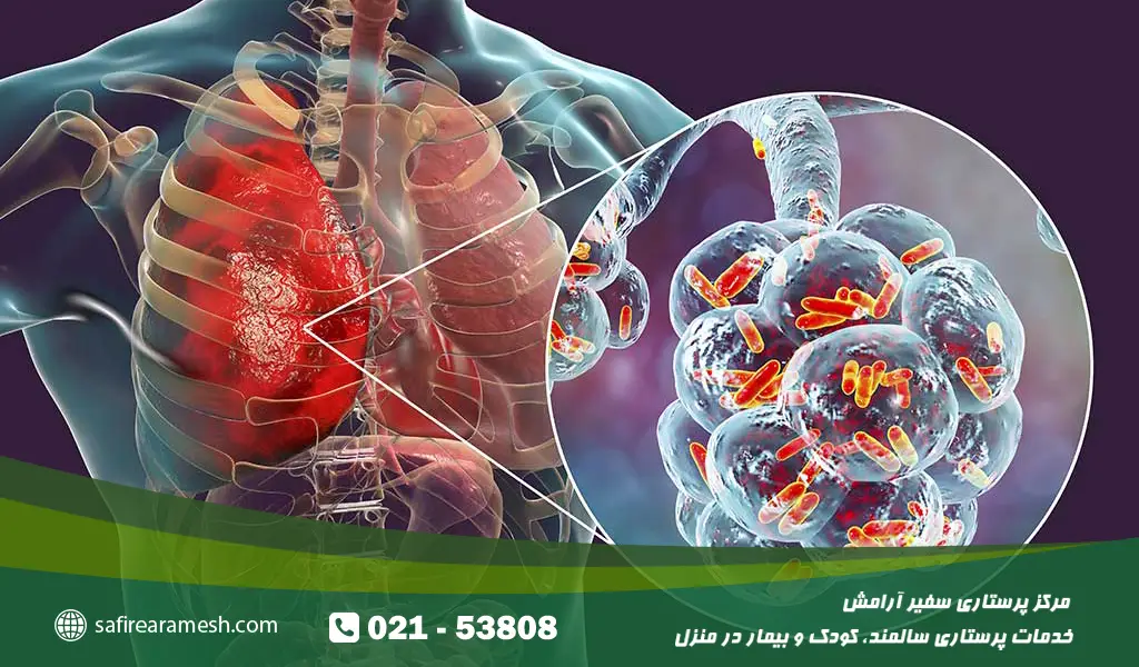 تشخیص بیماری پنومونی در سالمند